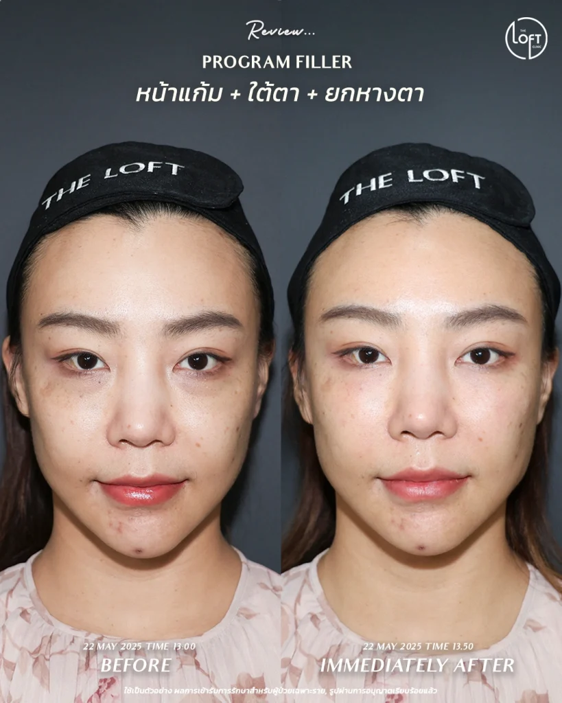 รีวิว program filler