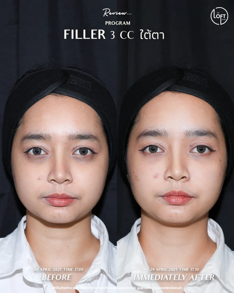 รีวิว program filler