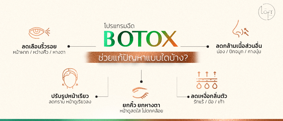 โบท็อกซ์ฉีดตรงไหนบ้าง