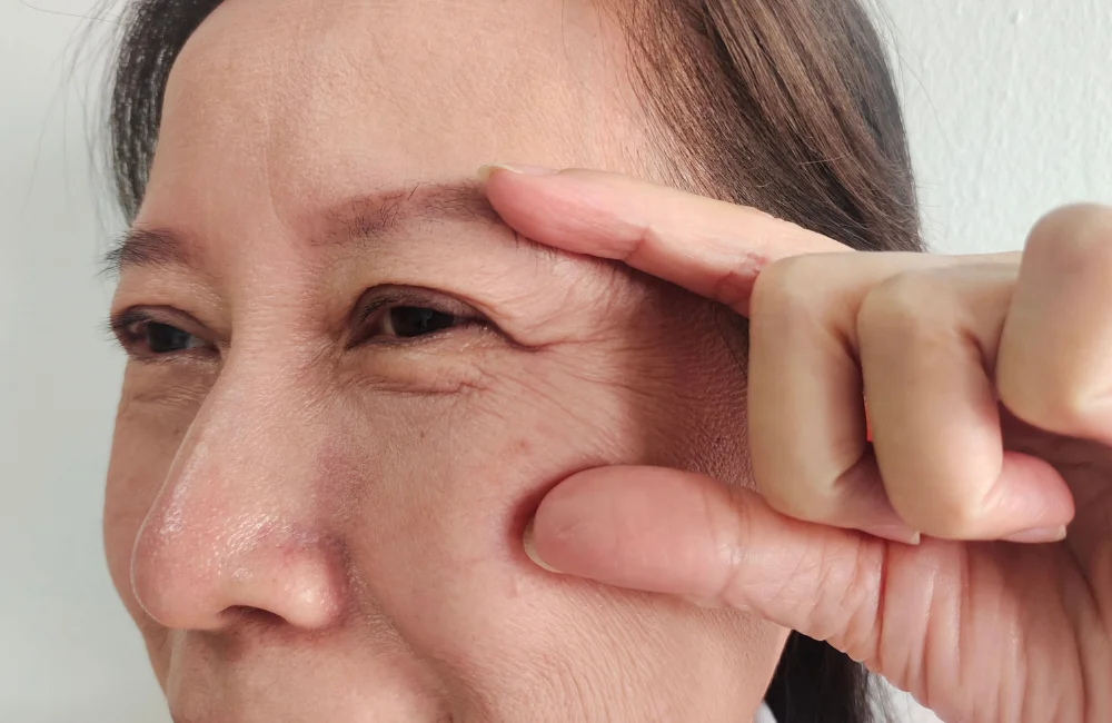 ปัจจัยที่ส่งผลต่อความคงทนของโปรแกรม Thermage
