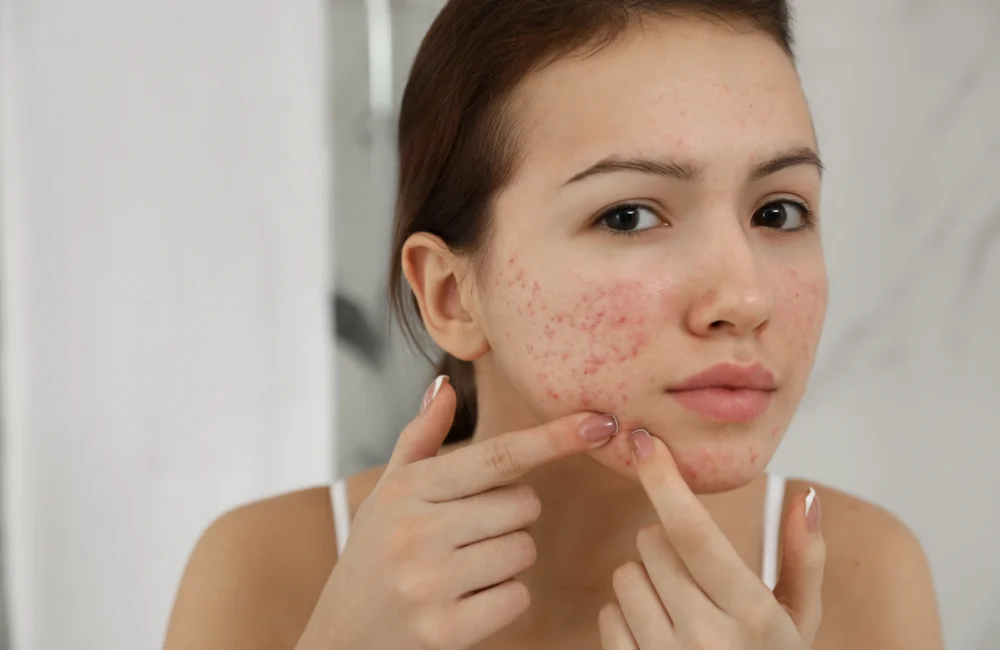 รวม 9 ปัญหาผิวหน้ายอดฮิต พร้อมวิธีแก้จบ ครบทุกสภาพผิว