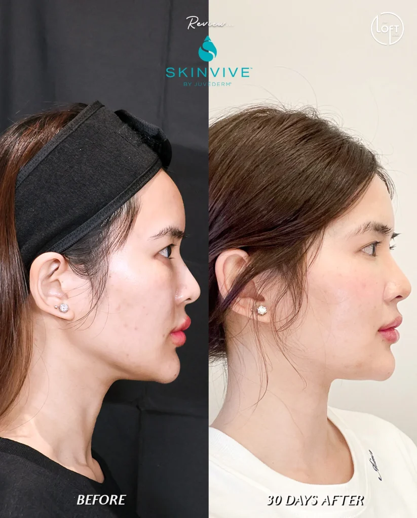 รีวิว Program Skinvive