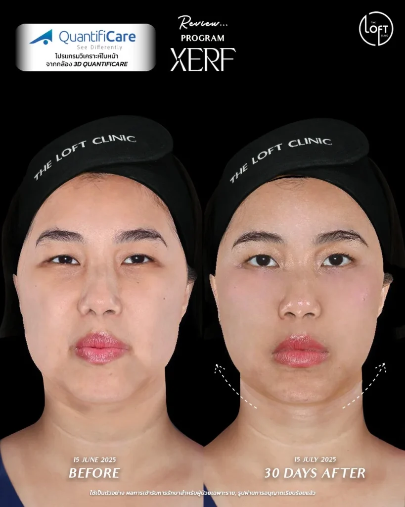 LINE_ALBUM_รีวิว k.แก้ว_260119_1