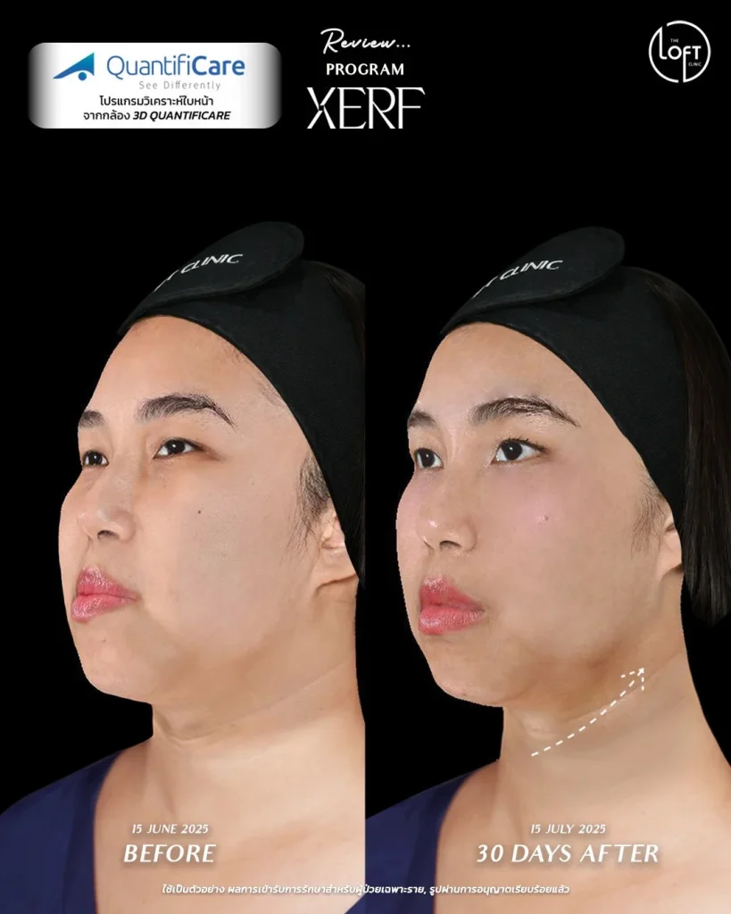 LINE_ALBUM_รีวิว k.แก้ว_260119_2