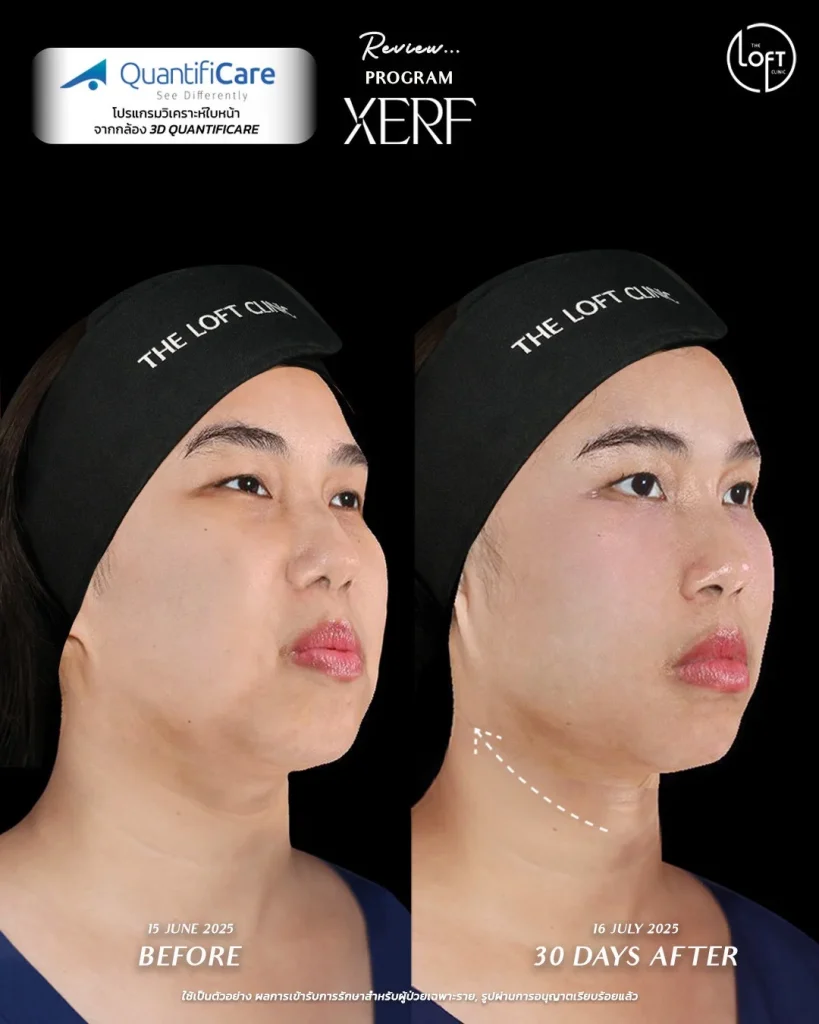 LINE_ALBUM_รีวิว k.แก้ว_260119_3