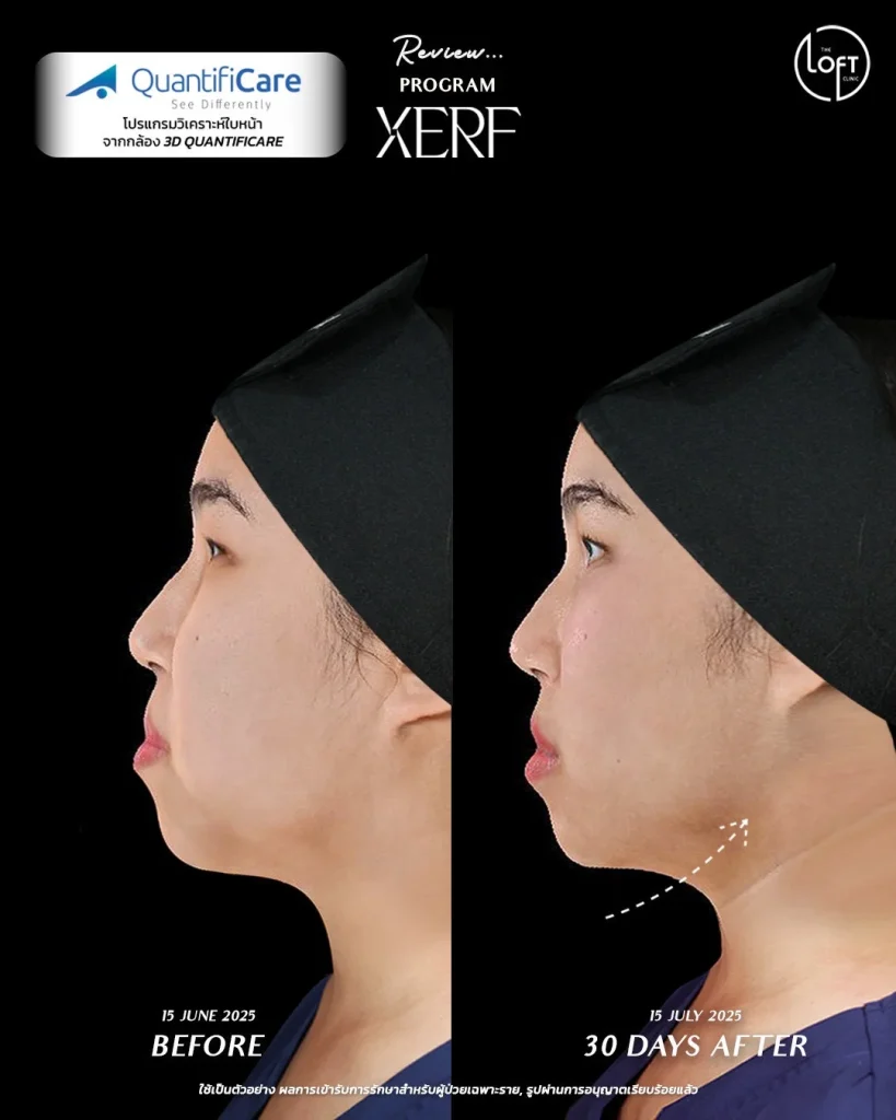 LINE_ALBUM_รีวิว k.แก้ว_260119_4