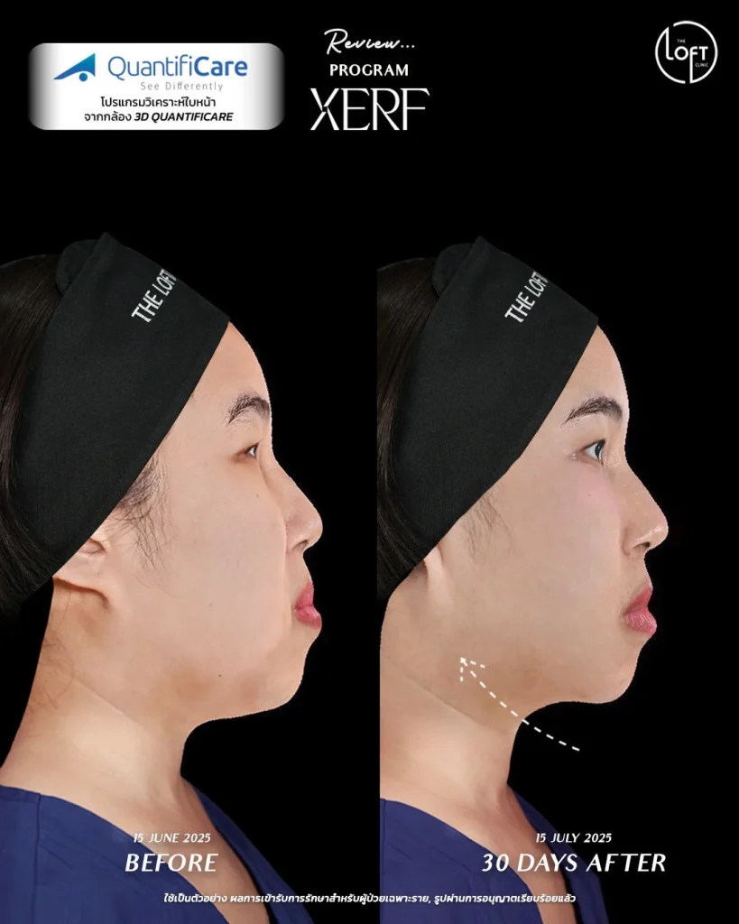 LINE_ALBUM_รีวิว k.แก้ว_260119_5