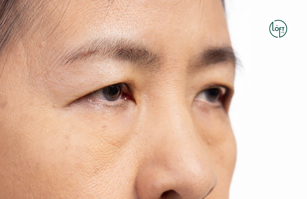 หางตาตก