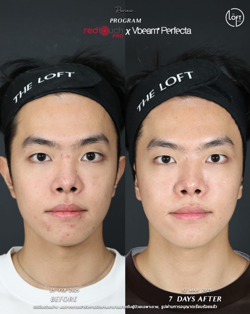 532521470_1179048954244789_711450245916204642_n