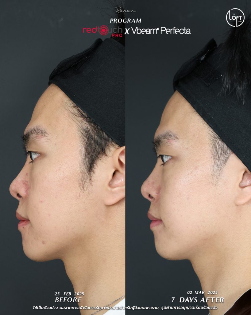 532953777_1179248834224801_6331107985339260336_n