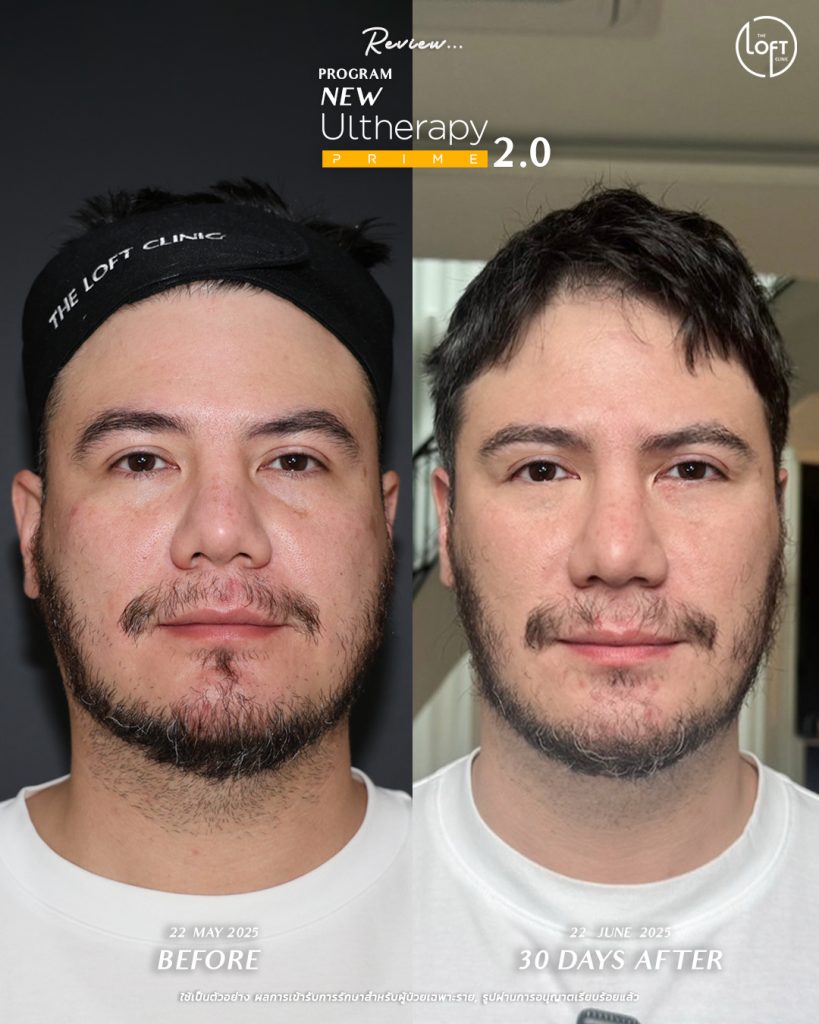 536278494_1184107200405631_3144354804309039940_n