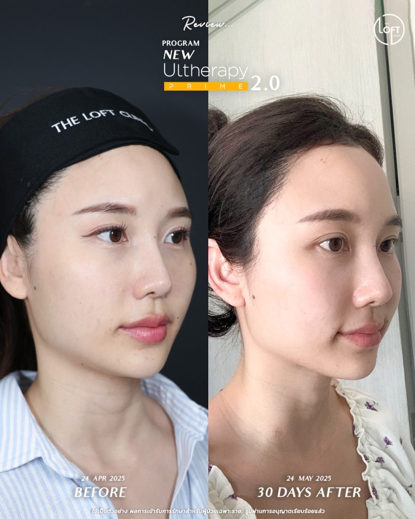 547217987_1202114825271535_5423914140038158908_n