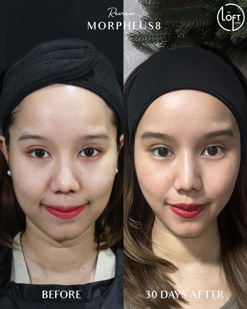 564588507_1236967301786287_4259313846970951880_n