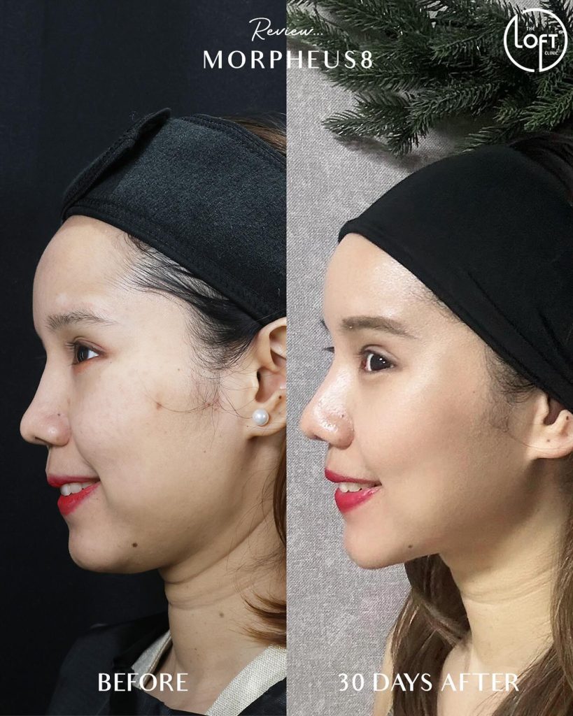 565303768_1236967305119620_11522757439950339_n