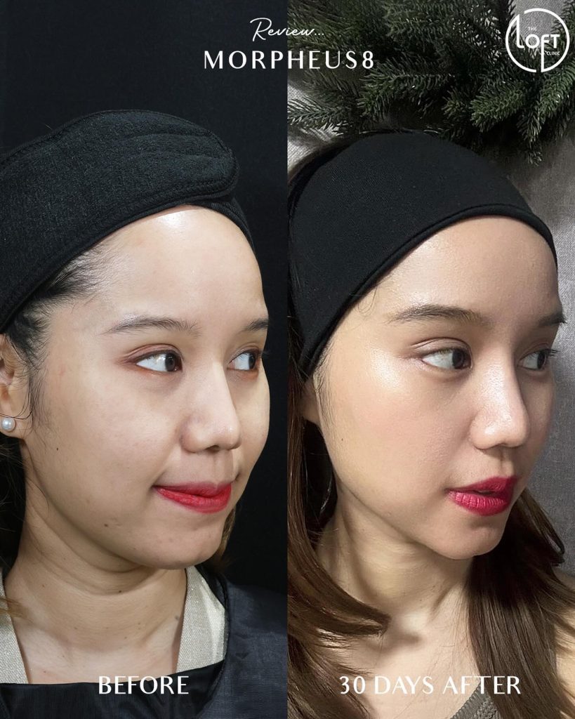 565656763_1236967281786289_6917442189955939041_n