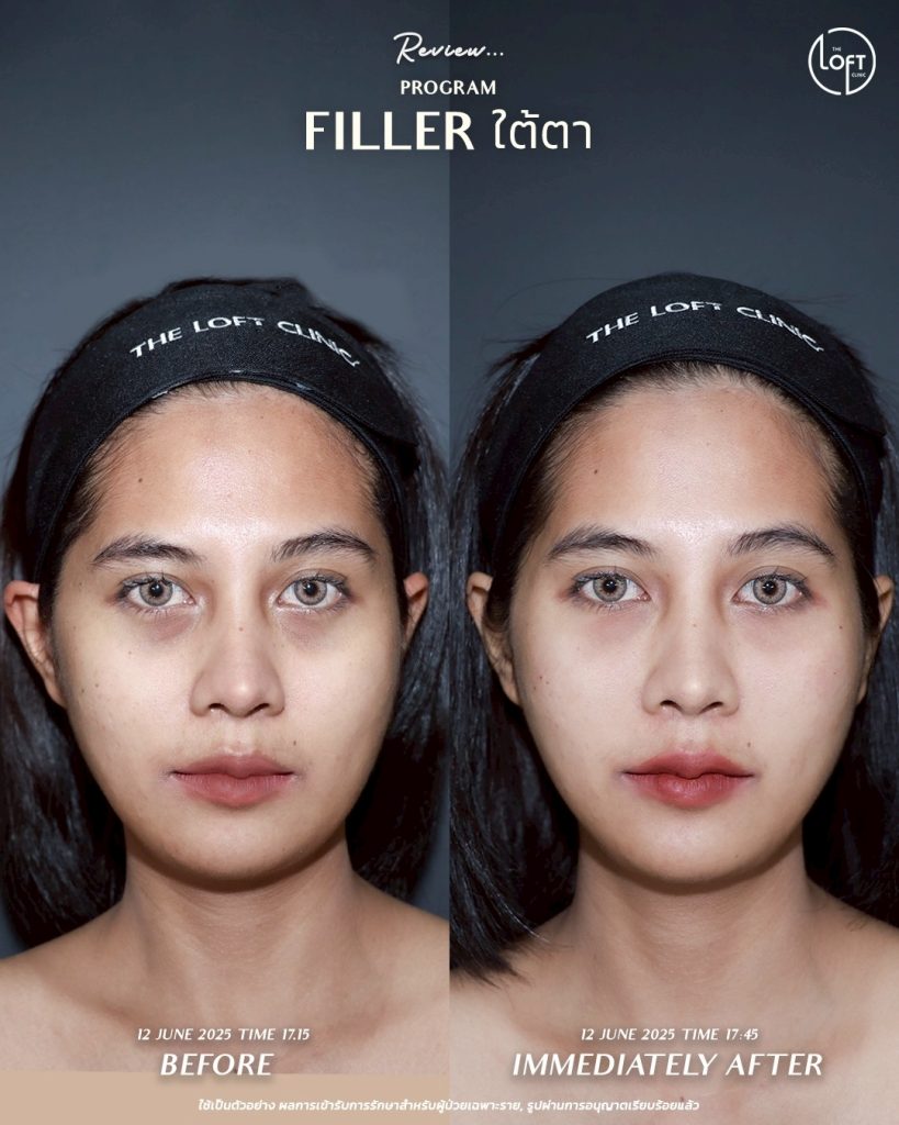 LINE_ALBUM_รีวิว คุณเจน Filler_250911_1