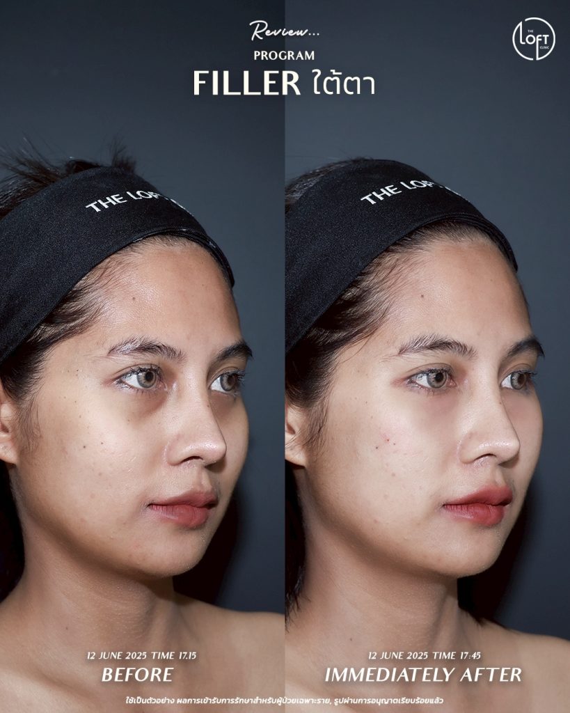 LINE_ALBUM_รีวิว คุณเจน Filler_250911_2