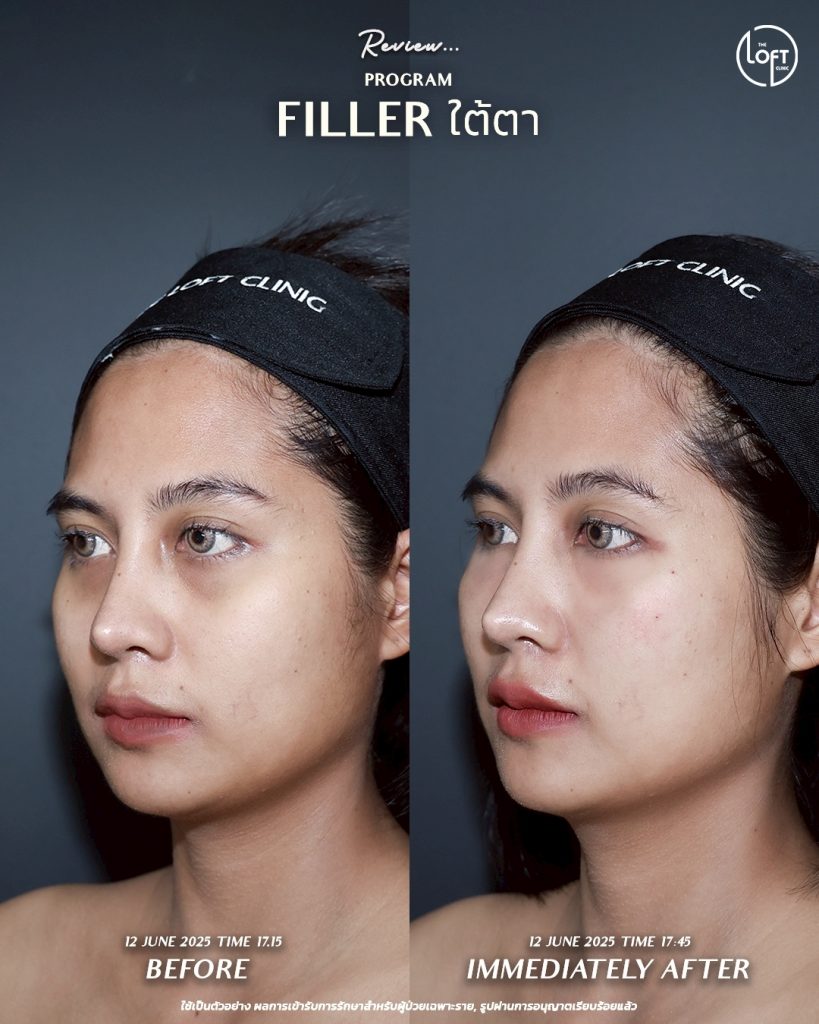 LINE_ALBUM_รีวิว คุณเจน Filler_250911_3