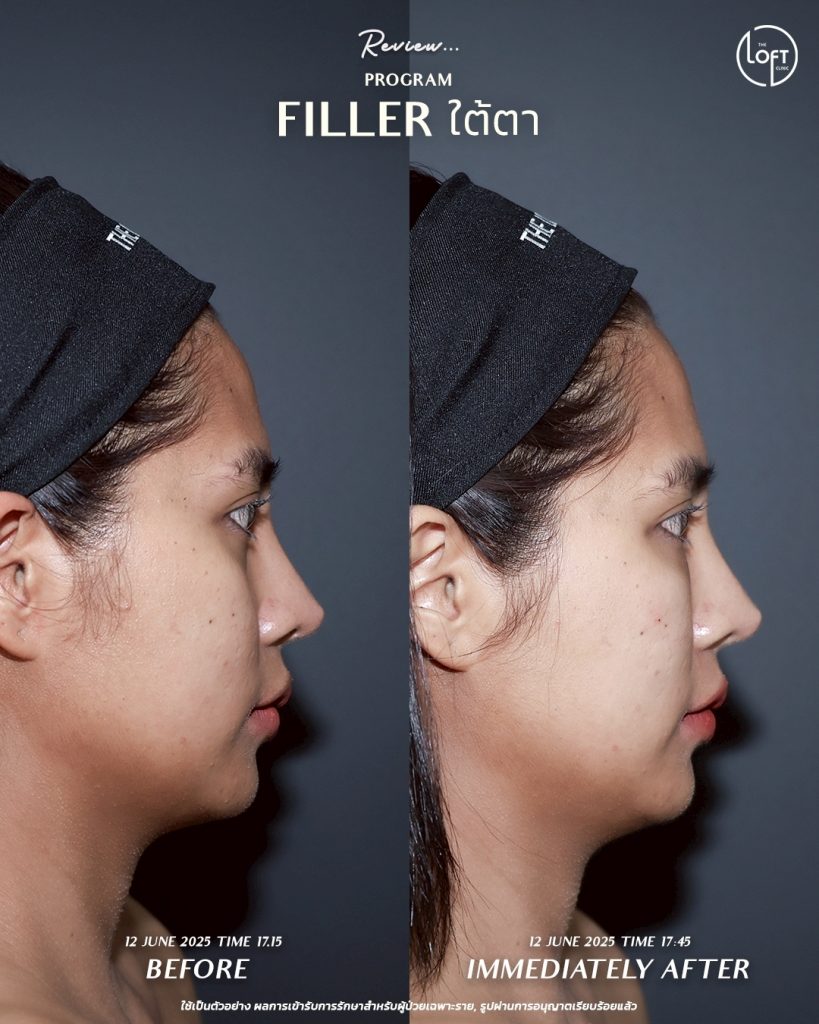 LINE_ALBUM_รีวิว คุณเจน Filler_250911_4