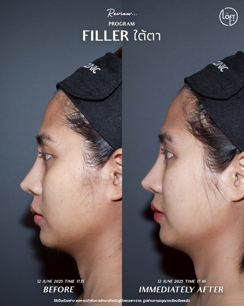 LINE_ALBUM_รีวิว คุณเจน Filler_250911_5