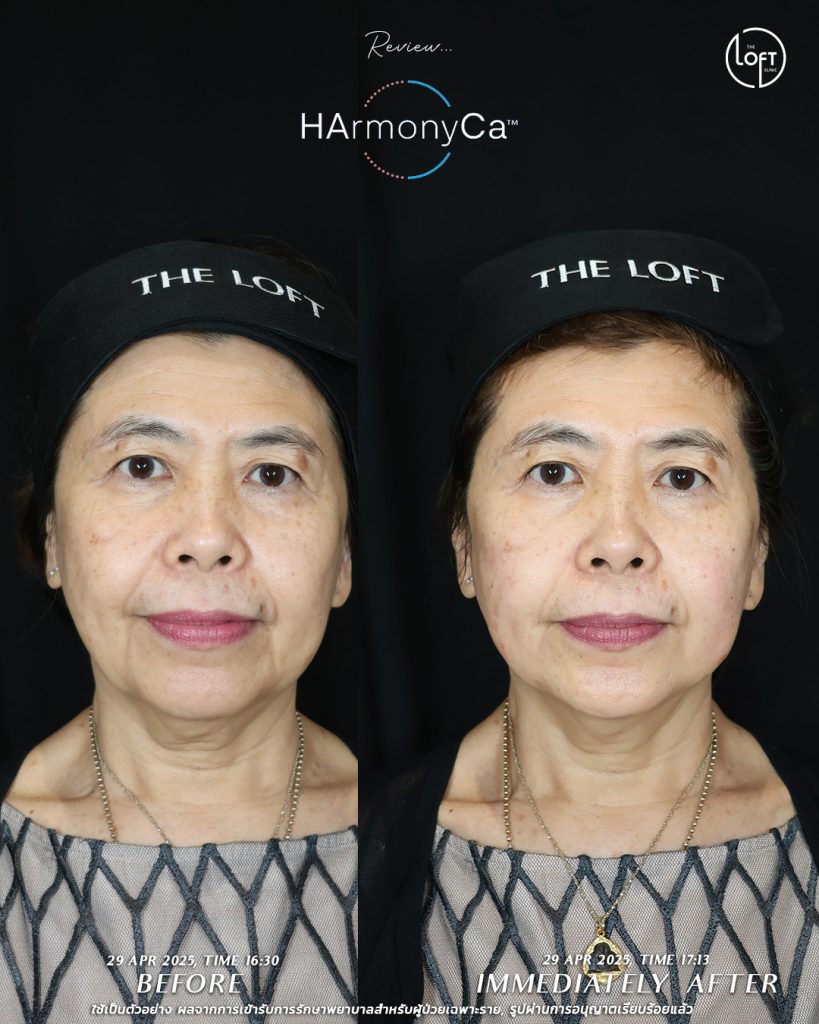 รีวิว_แม่หมอโมส_1