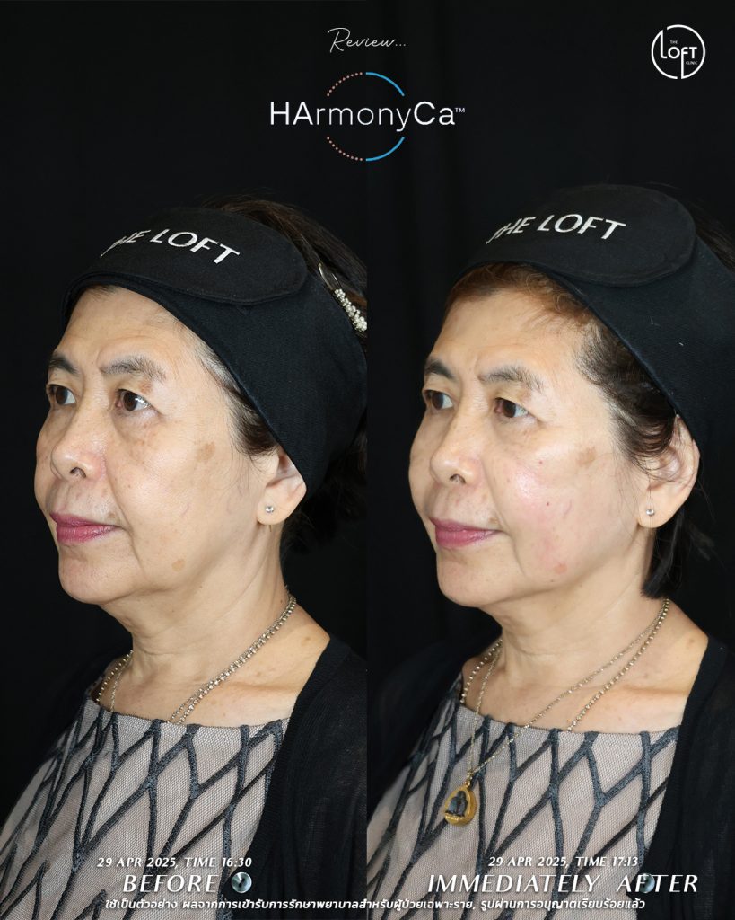 รีวิว_แม่หมอโมส_2(2)