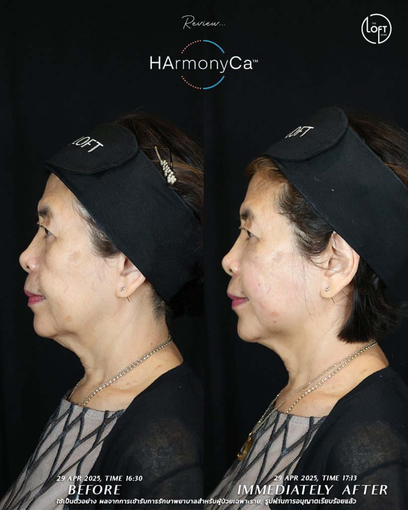 รีวิว_แม่หมอโมส_3(2)