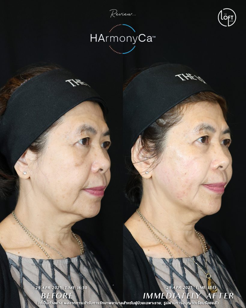 รีวิว_แม่หมอโมส_4