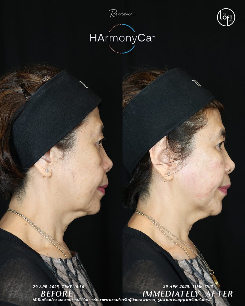 รีวิว_แม่หมอโมส_5