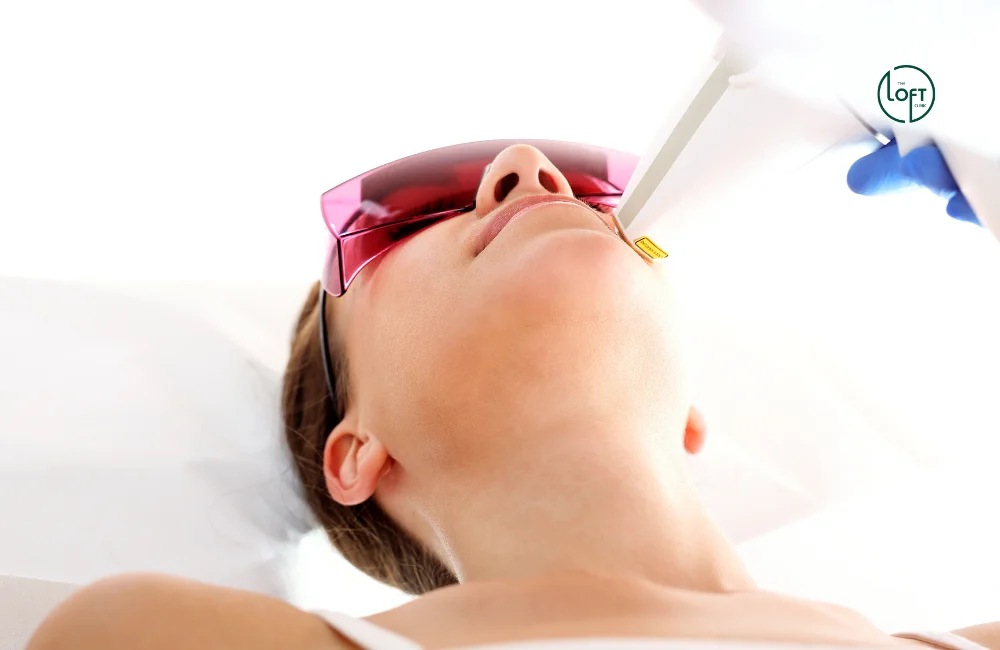 โปรแกรม Vbeam laser ที่ไหนดี