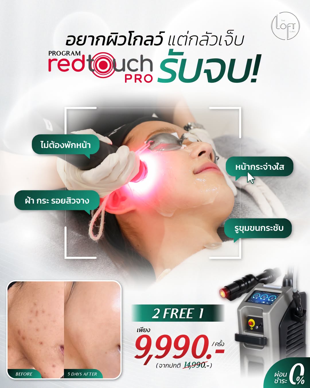 "โปรแกรมเลเซอร์ RedTouch Pro ผิวโกลว์ไม่เจ็บ ไม่ต้องพักหน้า ลดฝ้า กระ รอยสิว รูขุมขนกระชับ โปร 2 ฟรี 1 เพียง 9,990 บาท ผ่อน 0% - The Loft Clinic"
