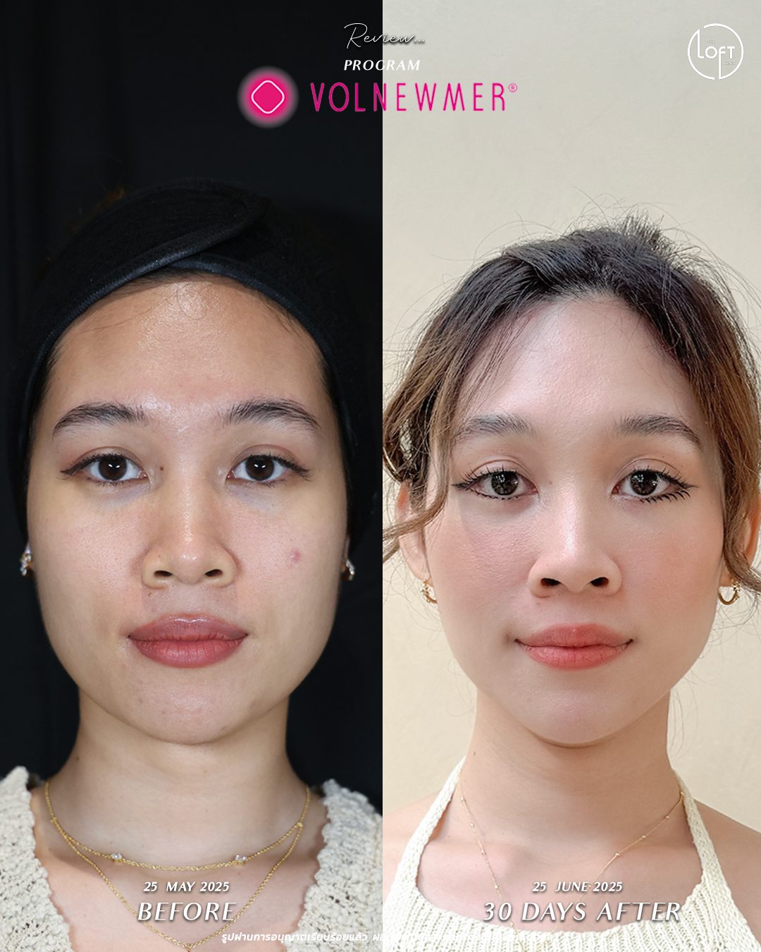 รีวิว program volnemer