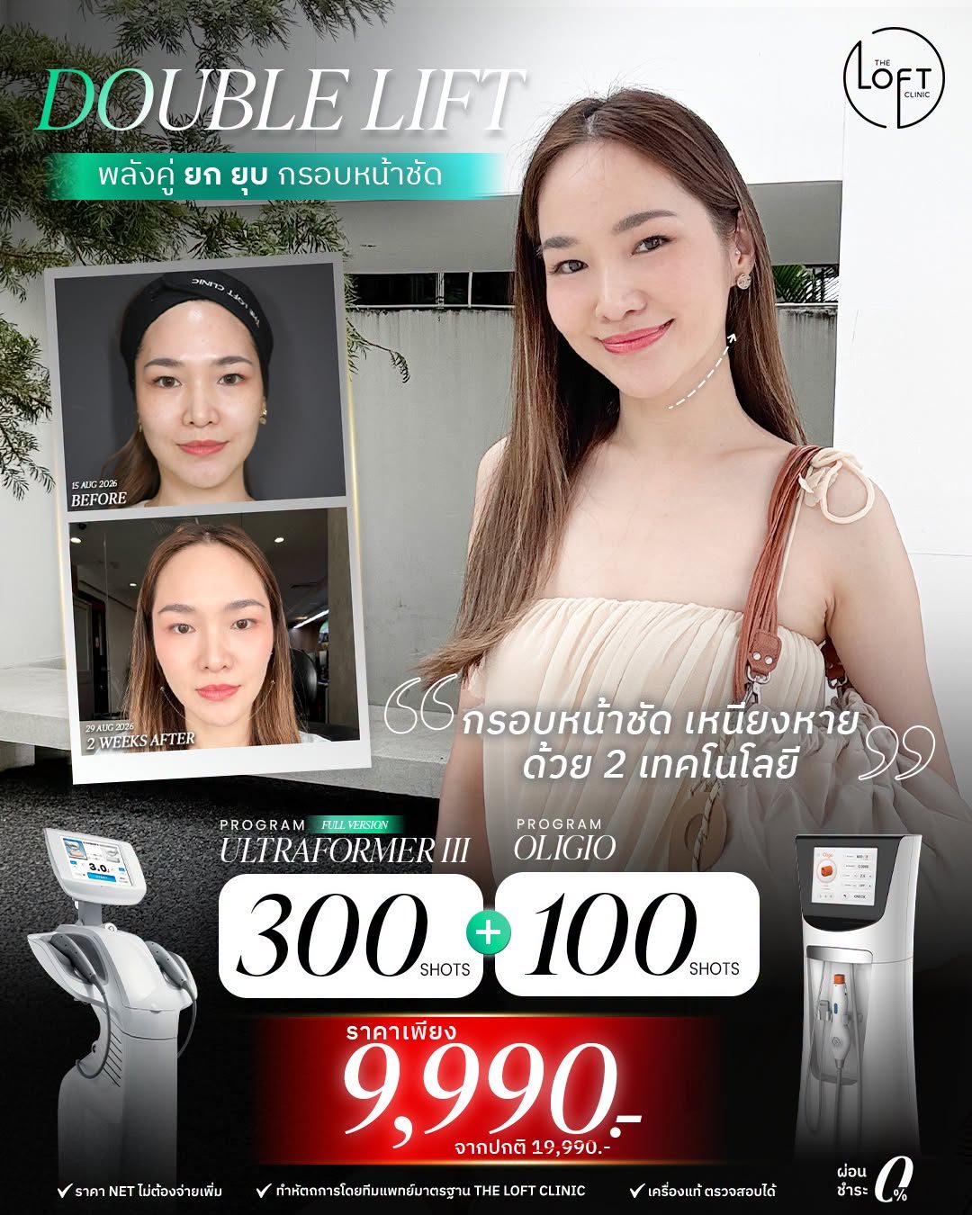 Double-lift_UFIII300+Oligio100